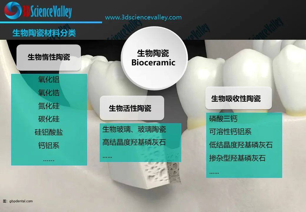 开启灿烂微笑，口内扫描+3D打印陶瓷修复体“催化”椅旁牙科的范式转变！