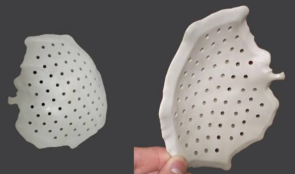 九院韦敏 | PEEK 3D在颅骨缺损方面的应用（一）