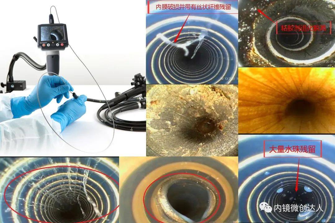 内镜清洗质量监测