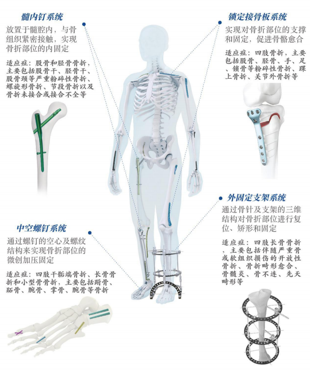 深度 | 骨科医疗器械行业分析报告