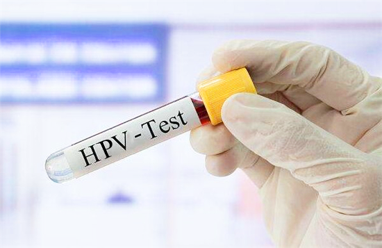 HPV检测百亿蓝海市场，国内IVD企业纷纷开始布局