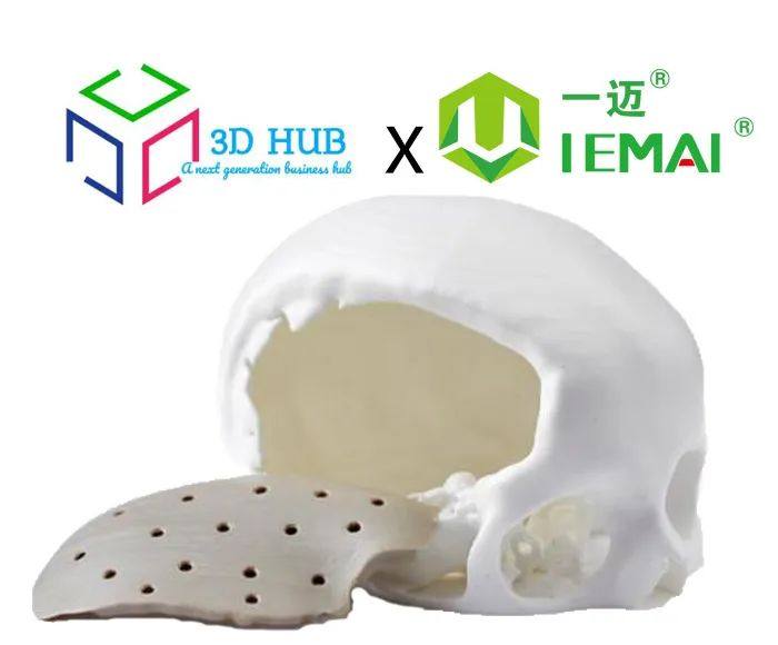 3D打印植入案例 | 孟加拉 3D HUB使用一迈PEEK3D打印解决方案生产颅骨植入物进入临床并取得成功