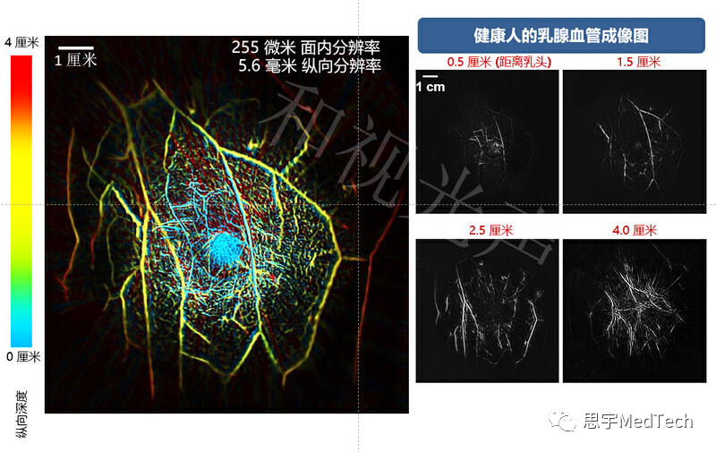 光声CT：“倾听”光的声音层析身体