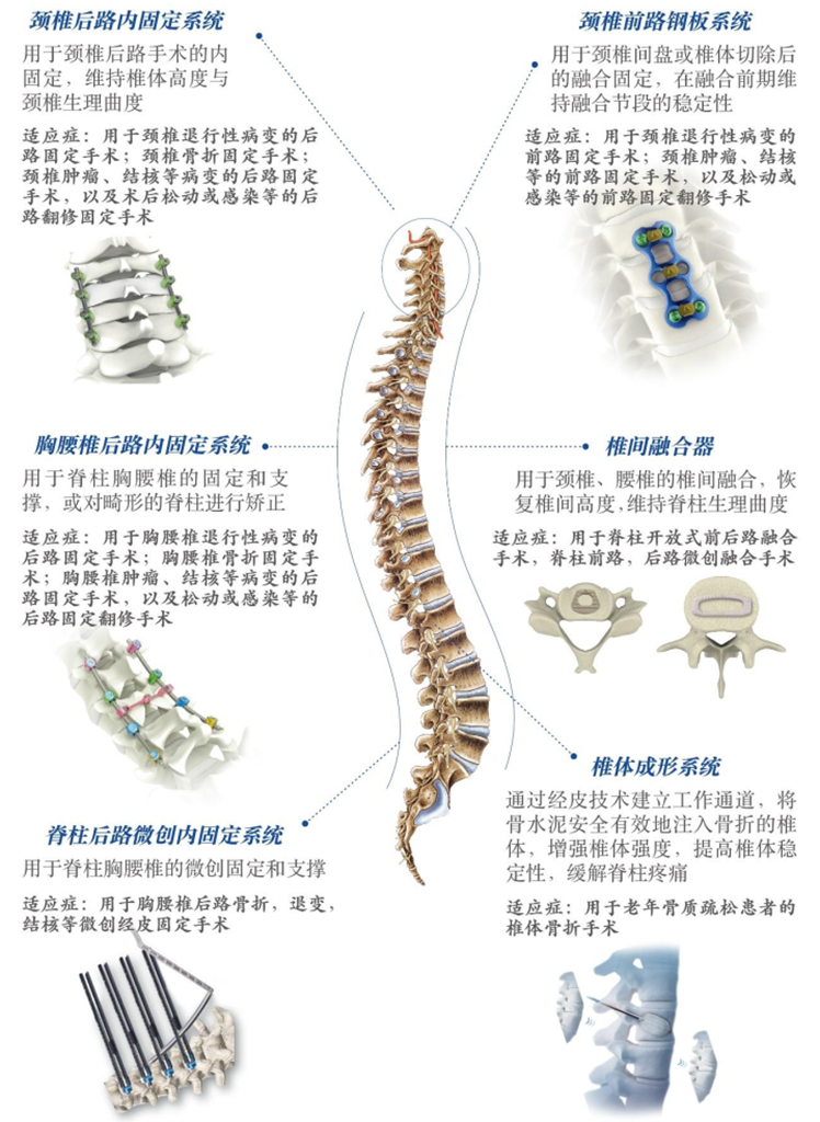 威高骨科:骨科植入耗材