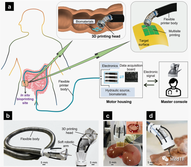 F3DB：具有生物3D打印功能的内镜机器人