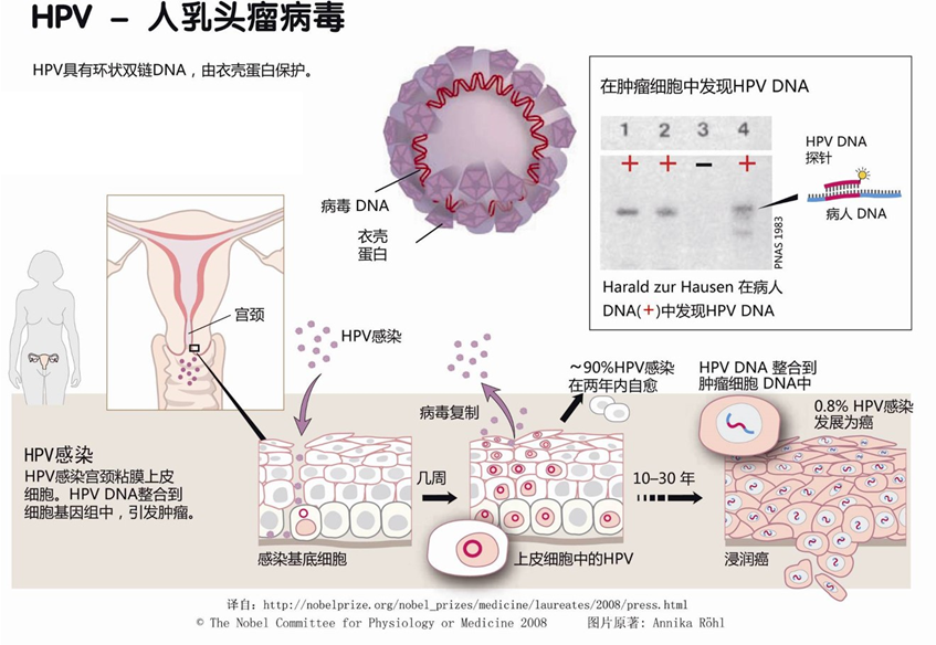 HPV检测百亿蓝海市场，国内IVD企业纷纷开始布局